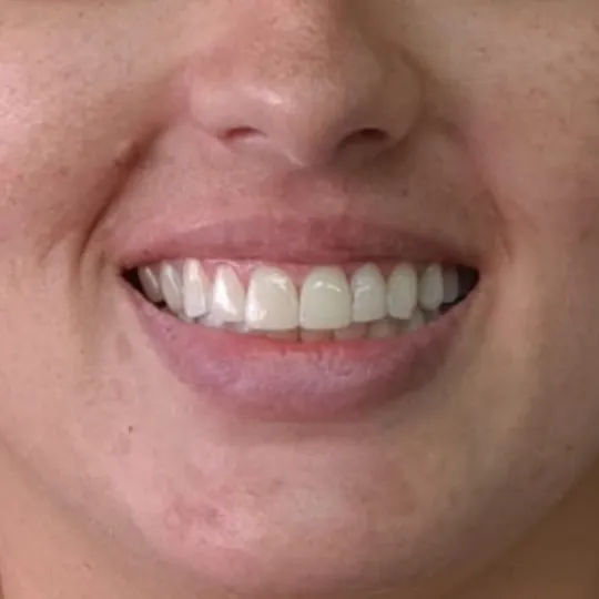até (2)